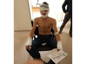 Evi yakmak isterken kendini ve arkadaşlarını yaktı