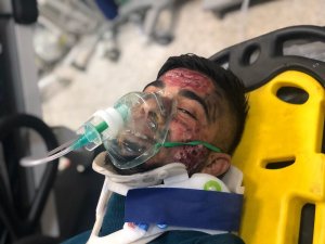 Hastanede yangın ve tahliye tatbikatı gerçeği aratmadı