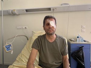 Paris'te gözünden yaralanan AA Foto Muhabiri Mustafa Yalçın, yaşadıklarını anlattı
