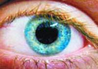 Alzheimer'a gözden erken teşhis