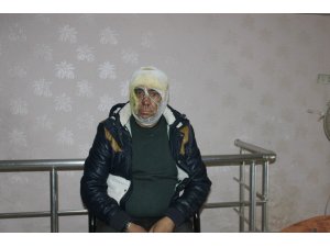 Evinde çıkan yangını söndürmek isterken yaralandı