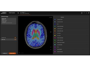 Yapay zeka MR ile birleşti teşhiste umut oldu