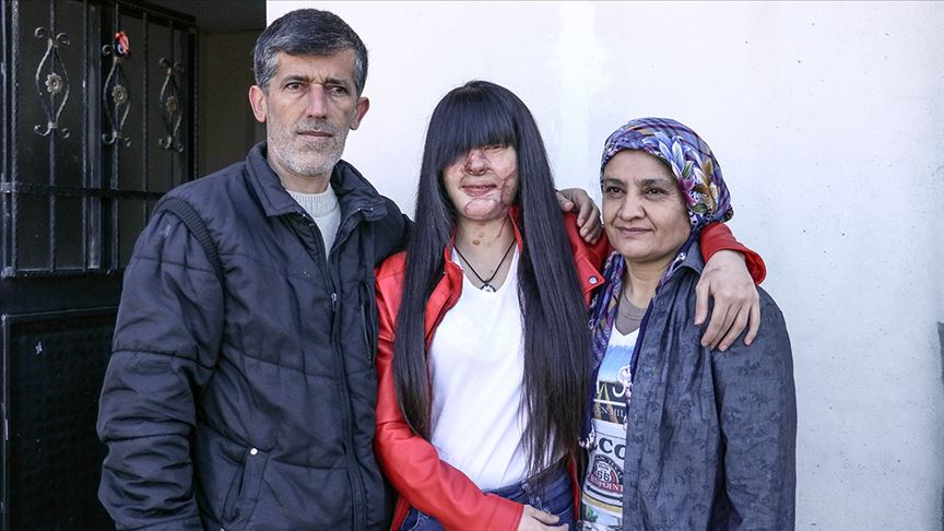 Asitli saldırı mağduru Berfin Özek ve ailesinden Cumhurbaşkanı Erdoğan'a teşekkür