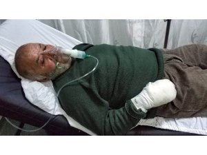 Yangında hayvanları kurtarmak isterken hastanelik oldu