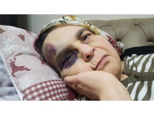 Şehir zorbası yaşlı çifti öldüresiyle dövdü