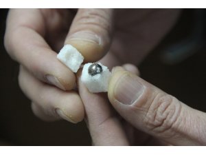 Samsun'da küp şekerden çıkan demir bilye şaşırttı