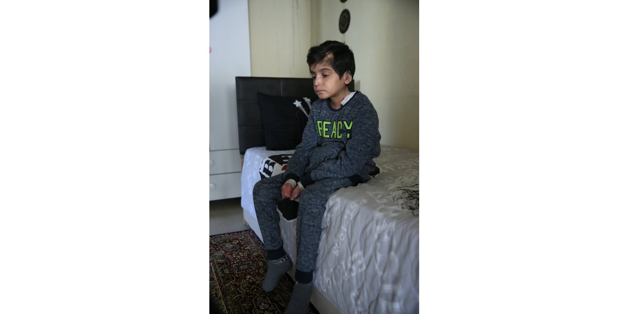 "Kelebek hastası" Hamza bedenine yüklenen ağır yükü taşımaya çalışıyor