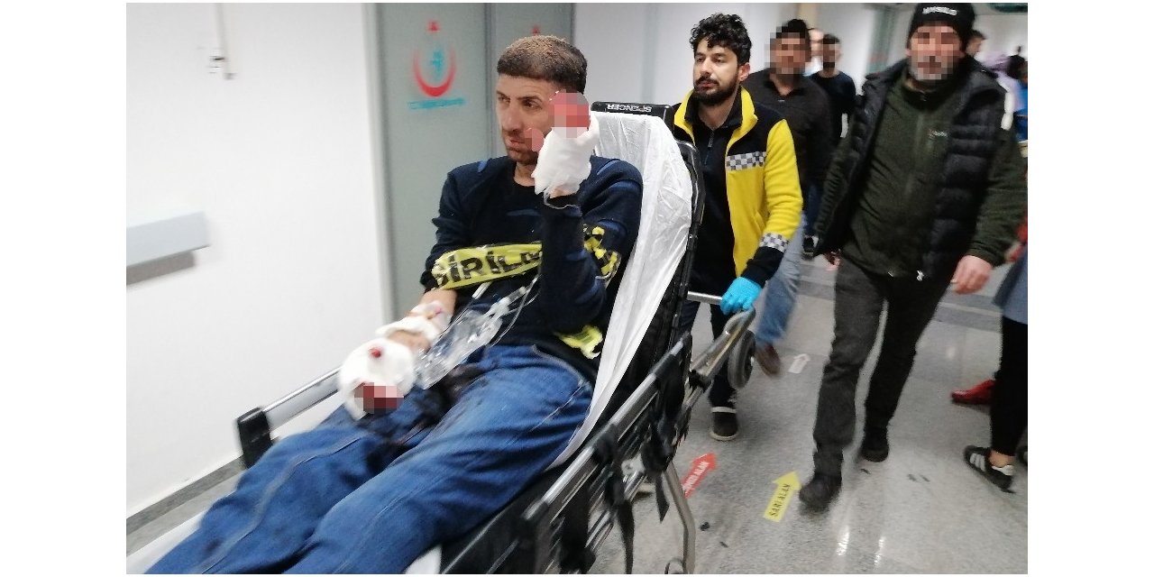 Elinde havai fişek patladı