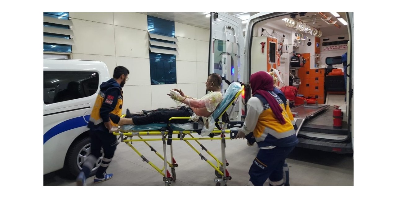 Eşi barışma teklifini kabul etmedi kendini yaktı