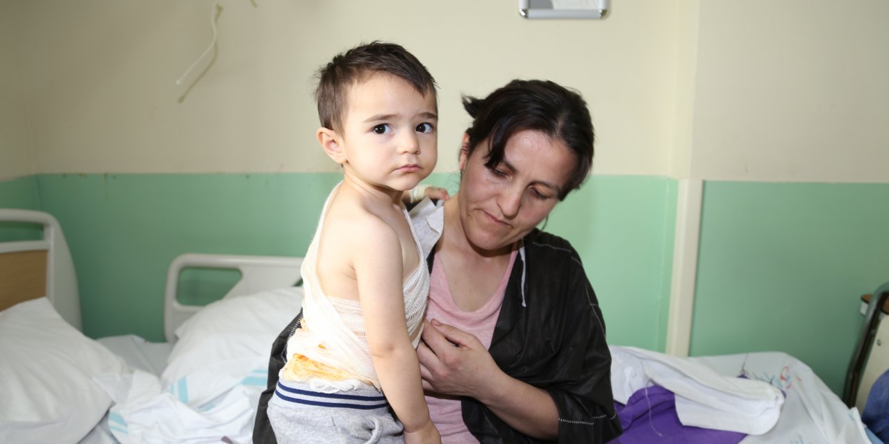 Annesinin alevlerin arasından kurtardığı minik Irmak Erzurum'da tedaviye alındı