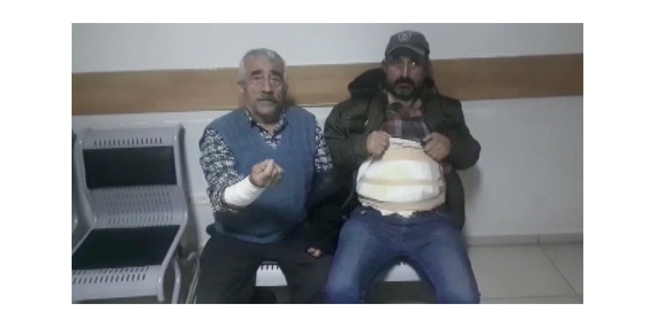 Cani koca eşini darp edip ailesini kaynar su dökerek yaktı