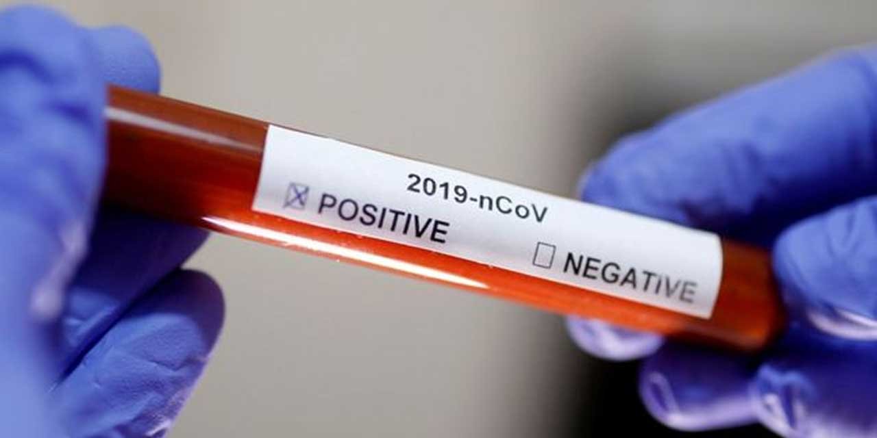 Koronavirüs Testi Nasıl  Yapılır?