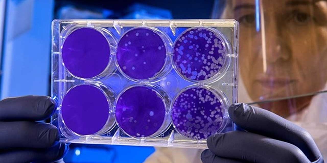 Hantavirüs pandemi yaratacak mı?