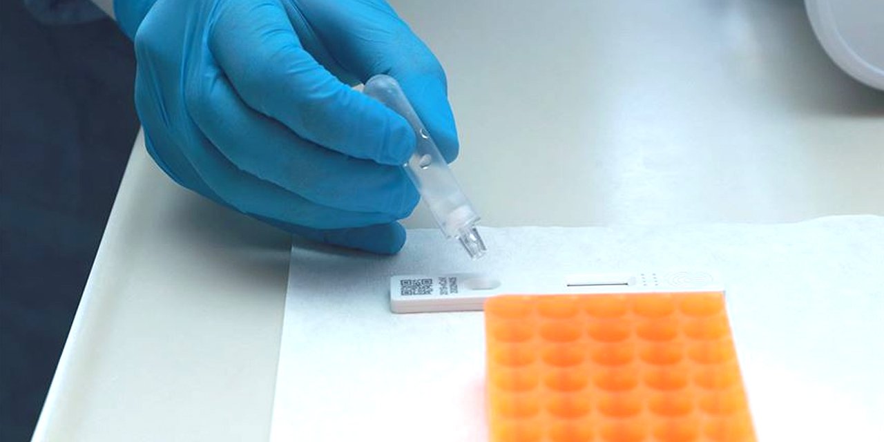 Türkiye'de 73 merkez 'Kovid-19 Tanı Laboratuvarı' oldu