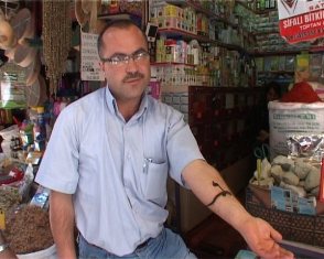 Profesör Sülükler cerrahların gözdesi