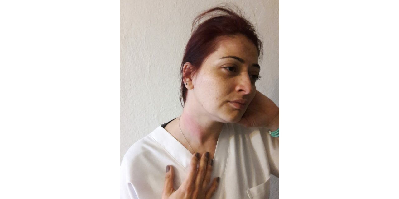 İzmir'de sağlık çalışanına yönelik darp iddası