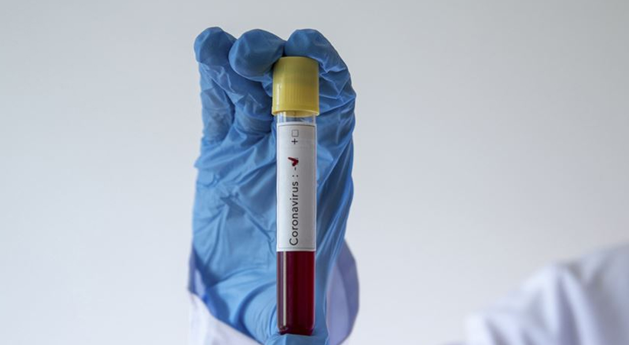 Türkiye'de koronavirüsten iyileşen hasta sayısı 786'ya ulaştı