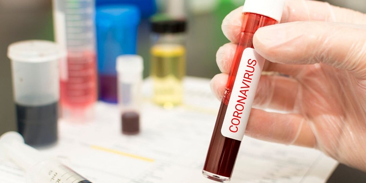 VİRÜS AYLAR HATTA YILLAR ÖNCE ÇIKMIŞ OLABİLİR