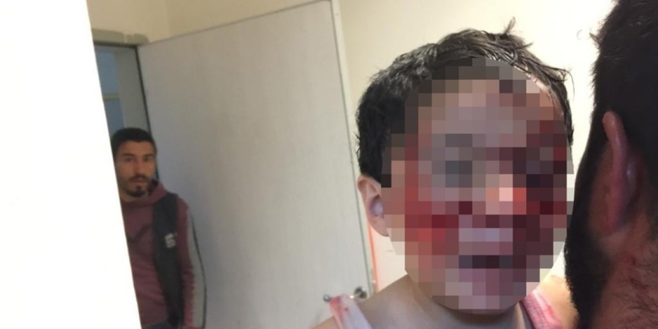 Şanlıurfa’da dehşet! Köpekler 6 çocuğu yaraladı