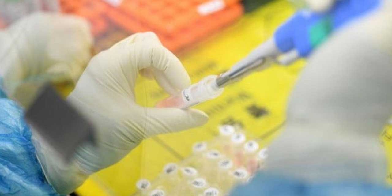 Türkiye 65 şehirde 114 laboratuvarıyla koronavirüsle savaşmaya devam ediyor