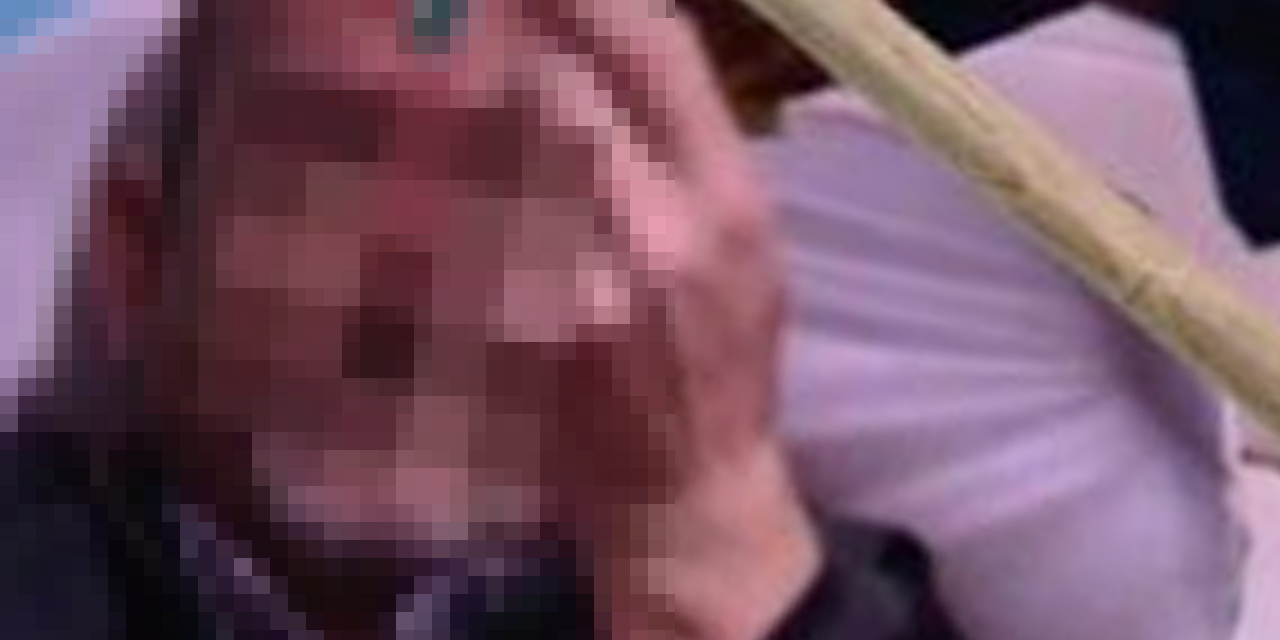 80 yaşındaki kayınvalidesinin kafasını yardı!