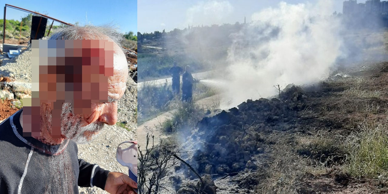 Antalya'da arazi kavgası! 72 yaşındaki adamın kafasını yarıp fidanlarını yaktılar