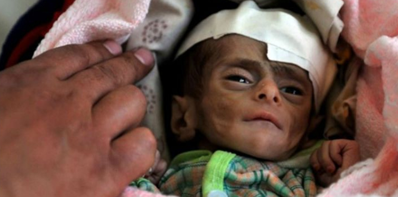 Açlıkla boğuşan Yemen'e bir de korona vurdu! Gıda fiyatları tavan yaptı