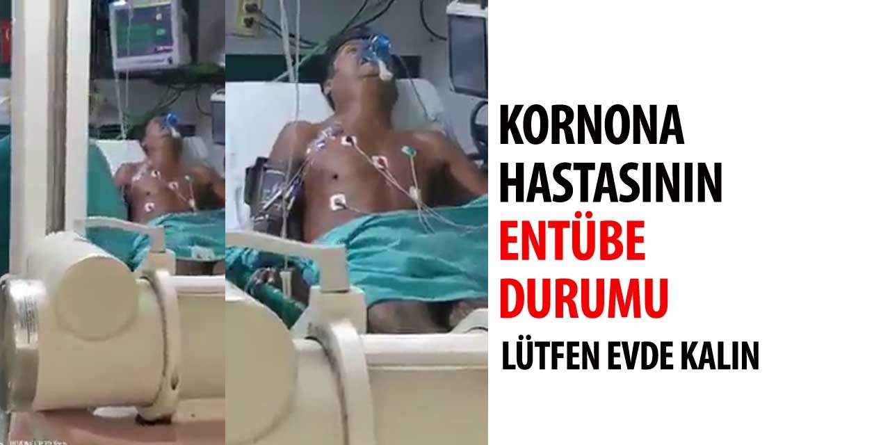Bir hastanın entübe durumu zorlukla nefes alıyor