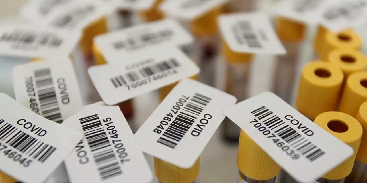 Koronavirüsü en ağır geçiren kan grubu belirlendi!