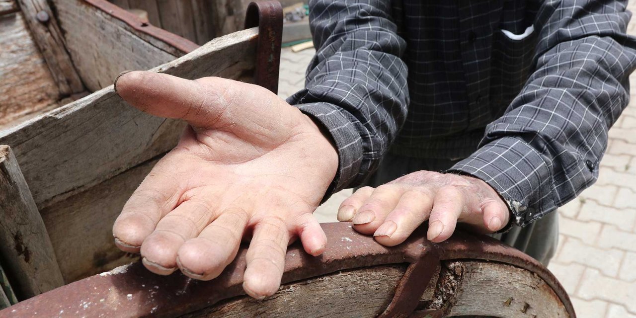 Yaşlı amcanın doğuştan 12 parmağı var!