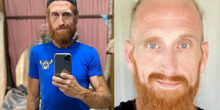Bir yılda 150 kilo verdi! Hem de spor yapmadan