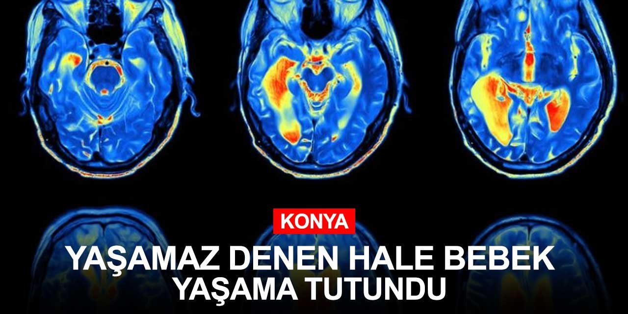 Yaşamaz denen Konyalı Hale bebek yaşama sımsıkı tutundu