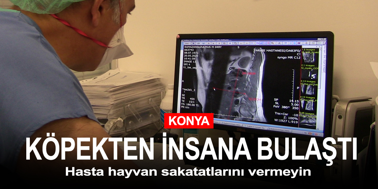 Konya'da köpekten insana bulaşan kist tedavi edildi!