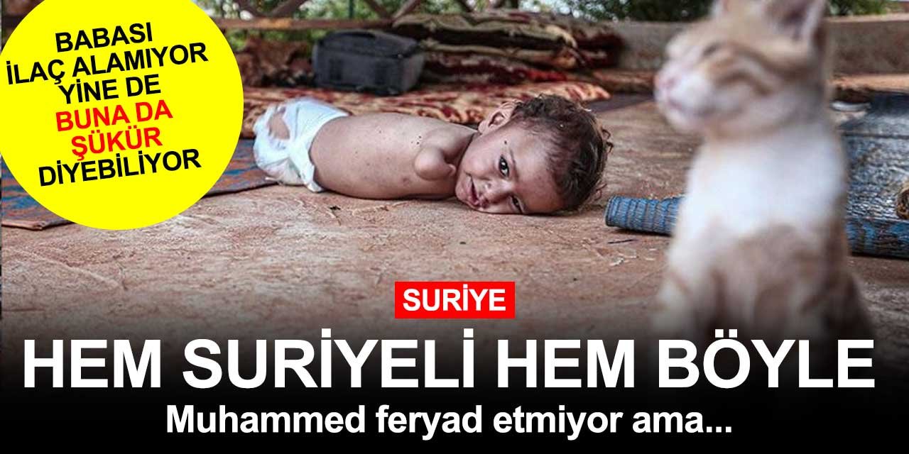 Suriyeli Muhammed'i görünce bugün de Allah'a şükrettik! Babası onu koşarken görmek istiyor