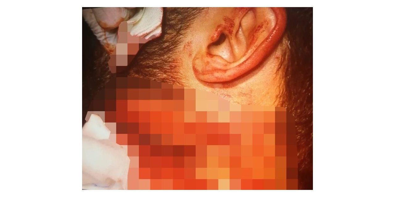 İzmir’de doktorun boğazını kesen saldırgana 20 yıl hapis cezası verildi
