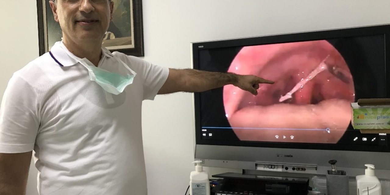 Balık sezonu açıldı, kılçık batması şikayetleri arttı