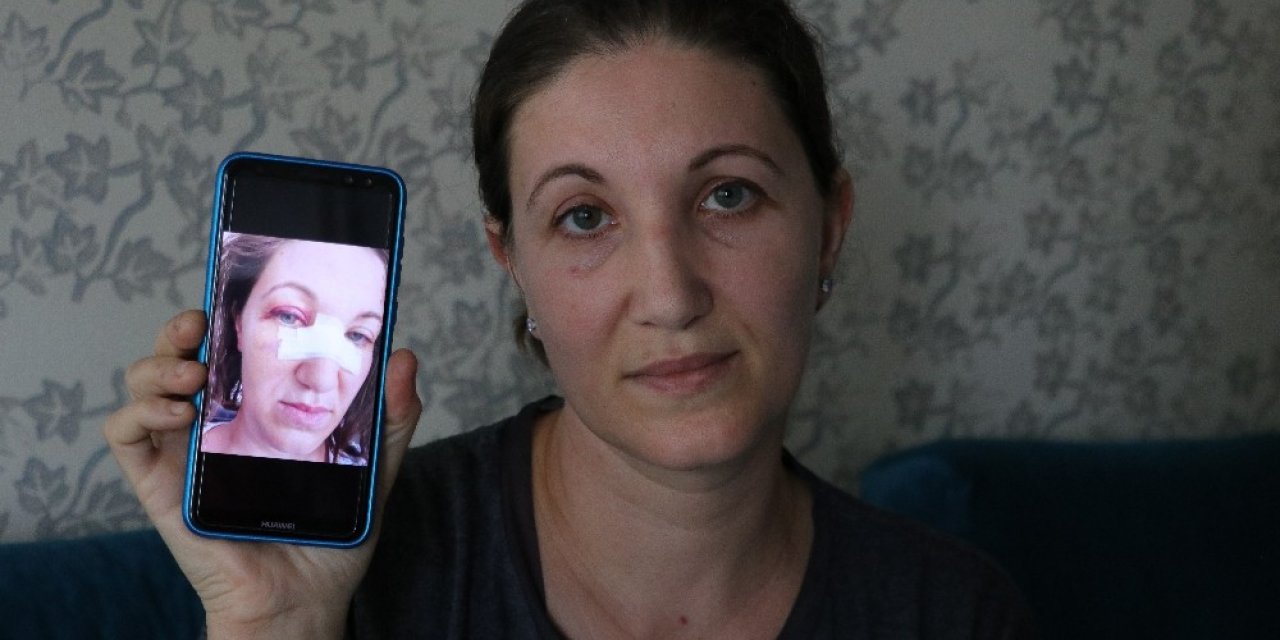 Gelinliği kirletip, kadın çalışanı darp ettiler