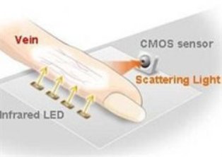 Damardan bankacılık
