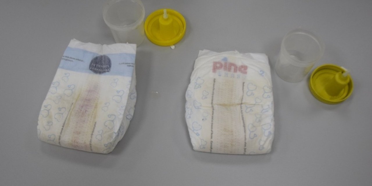 Yerli ve milli ‘Akıllı Bebek Bezi’ dünyaya açılıyor