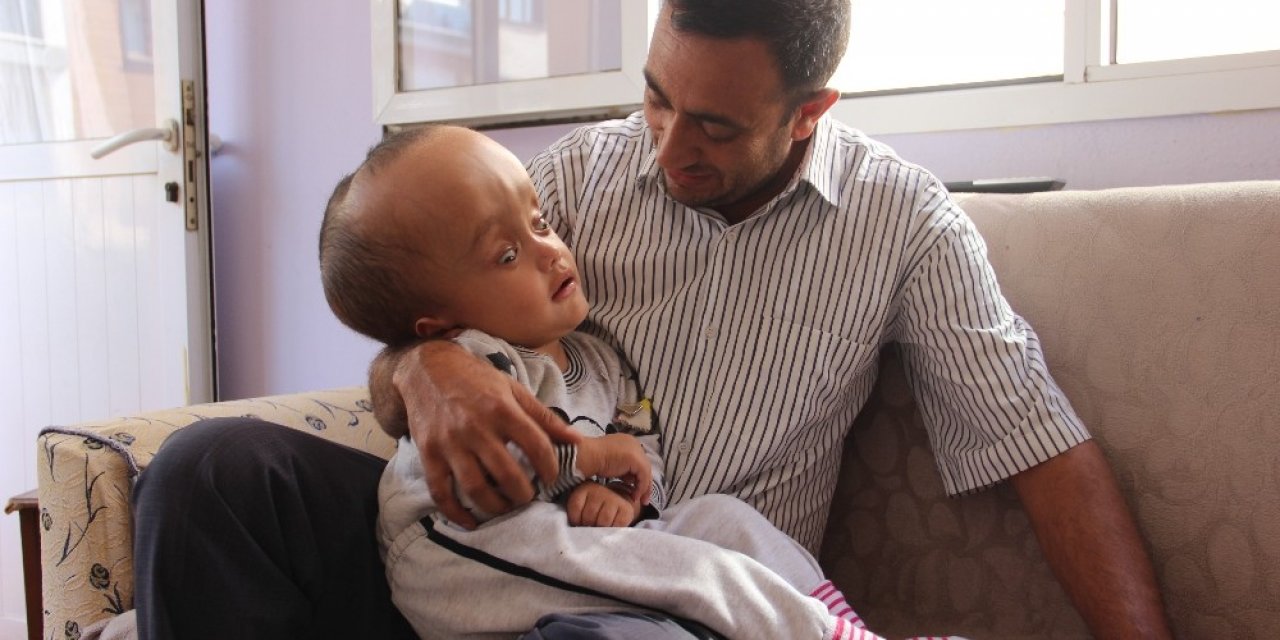 Minik Sercan’ın kafası küçülmeye başladı