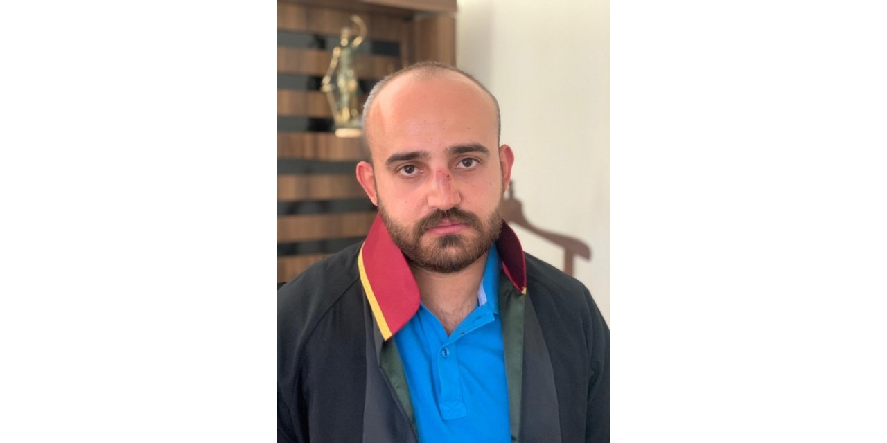 Boşanma davasında avukatın burnunu kırdılar