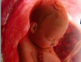 Doğmamış bebek annesini kurtardı