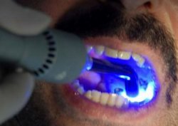 Tükürükten kalp krizi teşhisi