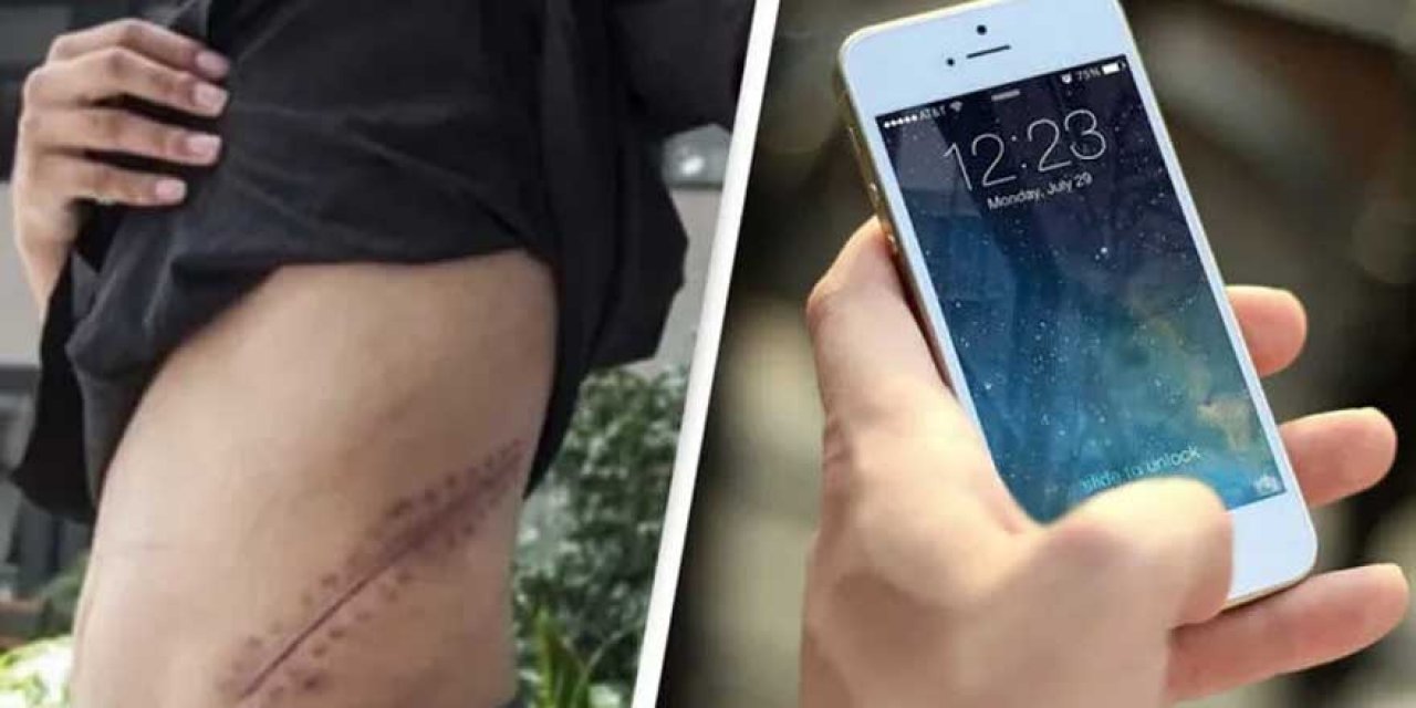 iPhone alabilmek için böbreğini sattı ömür boyu yatağa mahkum kaldı