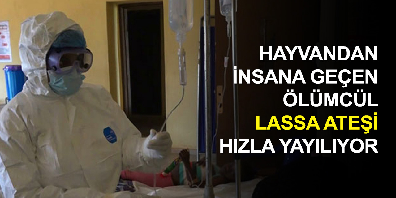 2020'de giderayak bir salgın daha çıktı! Lassa ateşi Kovid-19'dan daha tehlikeli