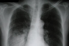 Yaz aylarının korkulu rüyası