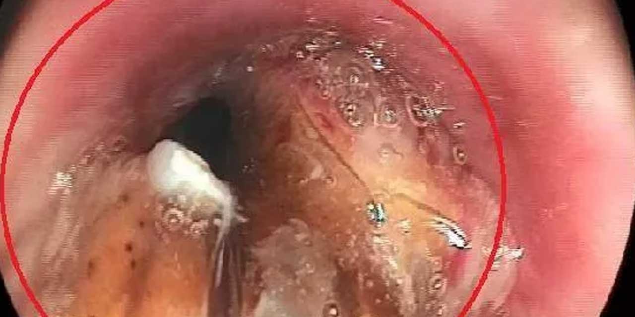 Korona diye gitti ceviz çıktı! Bursa'da ilginç olay