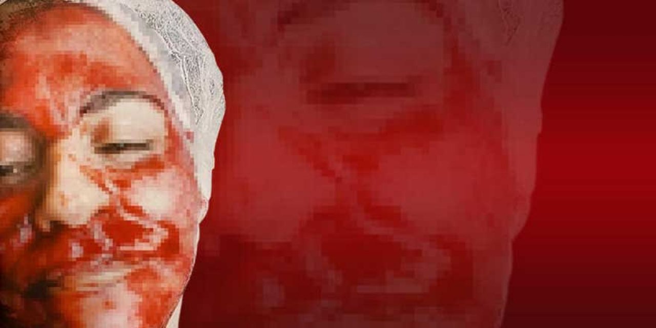 Güzellik merkezi terörü devam ediyor! Yüzünü görenler tanıyamadı