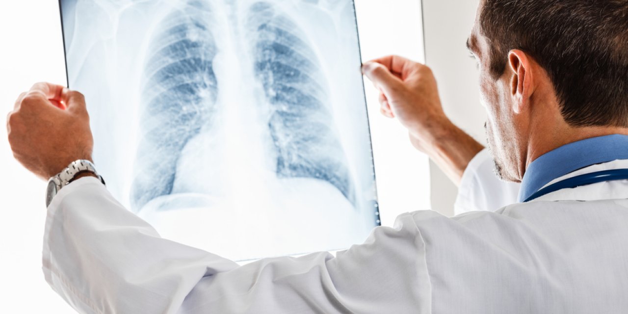 Sigara koronavirüs riskini 5 kat artırıyor