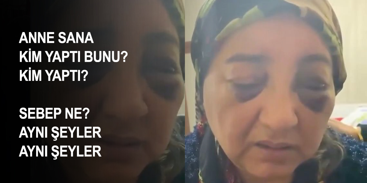 Annenin acısı evlatlarının da bizim de içimizi yaktı! Çocuklarının paylaşımı hayatını kurtardı